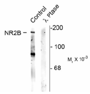 Western Blot: NMDAR2B [p Ser1480] Antibody [NB100-61103]